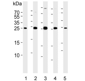 p21 Antibody / CDKN1A