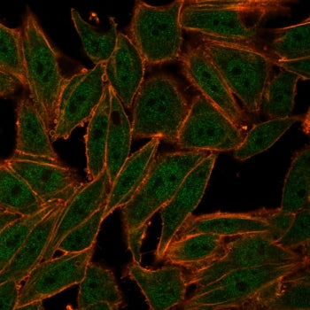 ZXDC Antibody / ZXD-like zinc finger protein