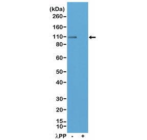 Glutamate Receptor 1 Antibody / GLUR1 / GRIA1 (pSer845)