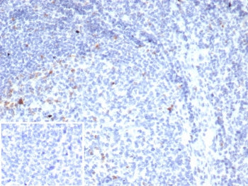 CTLA-4 Antibody / CD152