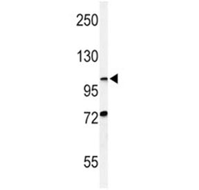 HIF1A Antibody (HIF-1 alpha)