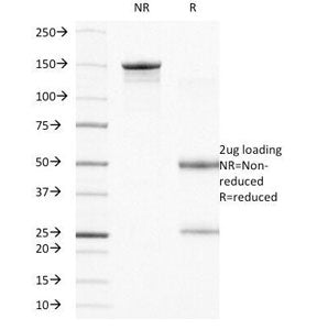 SDS-PAGE Analysis of Purified, BSA-Free Integrin Beta 4 Antibody (clone UM-A9). Confirmation of Inte