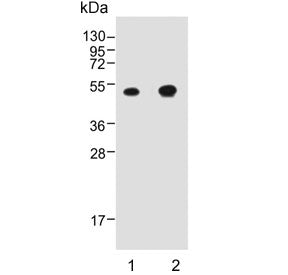 Cathepsin E Antibody / CTSE