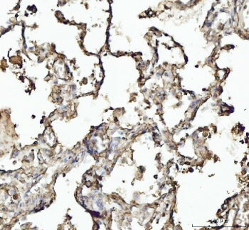 Annexin VI Antibody