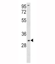 Superoxide Dismutase 3 Antibody (SOD3)