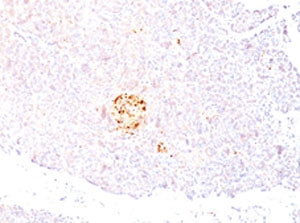 NSE Antibody / Neuron Specific Enolase