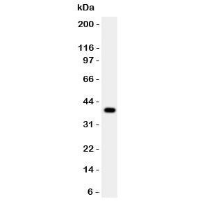 Cathepsin B Antibody