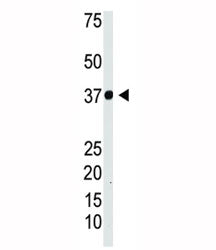 IKB alpha Antibody (IKBa)