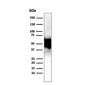 HSP60 Antibody