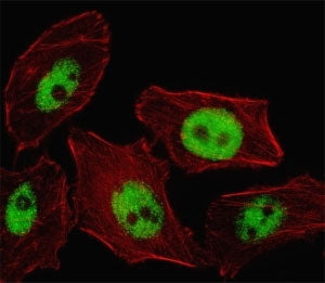 Fluorescent image of U251 cell stained with PHOX2B antibody. Alexa Fluor 488 conjugated secondary (g