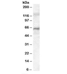 IRAK3 Antibody