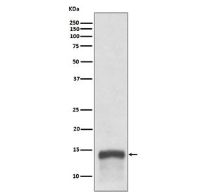 S100A9 Antibody / MRP14 / Calgranulin B / Calprotectin L1H