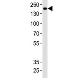 Insrr Antibody