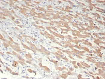 GCHFR Antibody / GFRP