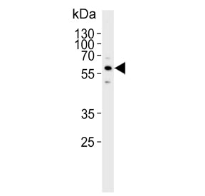 Cytochrome P450 3A5 Antibody / CYP3A5