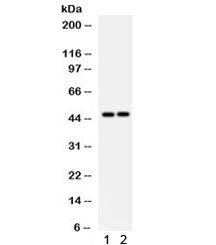 PTPN2 Antibody