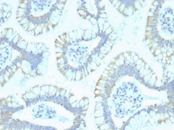 SMAD4 Antibody