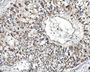 Indoleamine 2,3-dioxygenase 2 Antibody / IDO2 / INDOL1