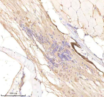 IHC staining of FFPE zebrafish spinal cord tissue with Rcc2 antibody, HRP-labeled secondary and DAB