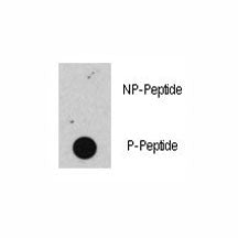 Phospho-Rb Antibody (pS608)