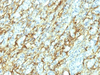 FN1 Antibody / Fibronectin