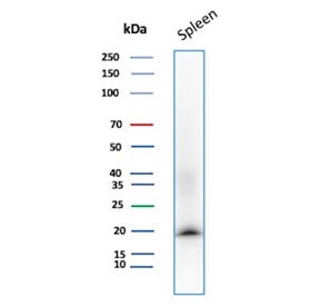 STMN1 Antibody / Stathmin 1