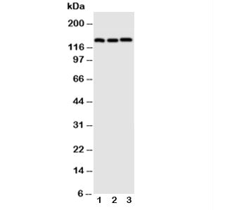 Western blot testing of VE Cadherin antibody; Lane 1: A549; 2: HeLa; 3: MCF-7 cell lysate. Expected