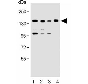 UBE4B Antibody
