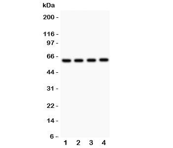 Western blot testing of SynCAM antibody and Lane 1: rat brain; 2: human HeLa; 3: (h) A549; 4: (h) Ju