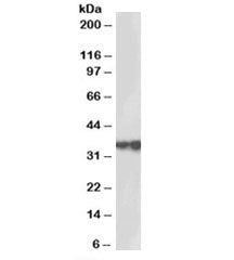 HSD17B3 Antibody