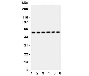 AKT2 Antibody