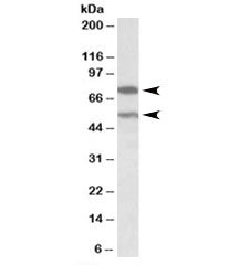 Western blot testing of human cerebellum lysate with PRODH antibody at 0.3ug/ml. Both isoforms are d
