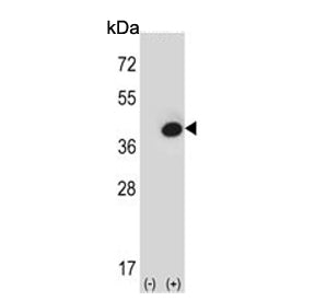 FBP1 Antibody / Fructose-1,6-bisphosphatase 1