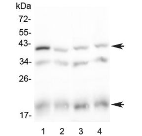 Baff receptor Antibody / Baff-r