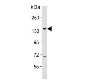 MAP3K15 Antibody
