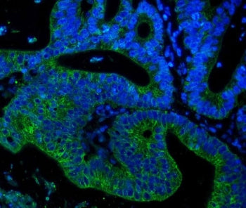 Cytokeratin 18 Antibody