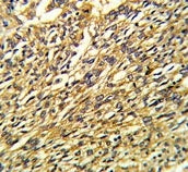 KCNJ2 Antibody / Inward rectifier potassium channel 2