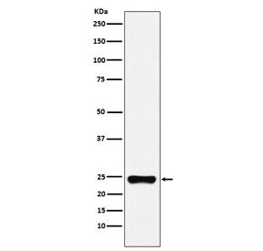 BAG2 Antibody