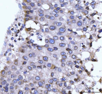 NUP210 Antibody / Nuclear pore membrane glycoprotein 210
