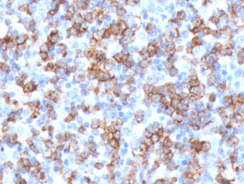 CD8A Antibody