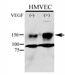 Phospho-KDR Antibody (pY996)