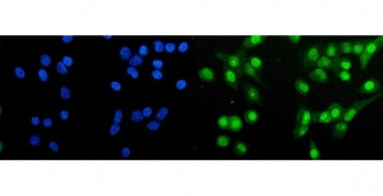 Huntingtin-associated protein 1 Antibody / HAP1