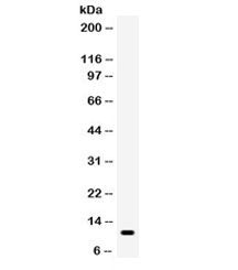 CCL5 Antibody / RANTES