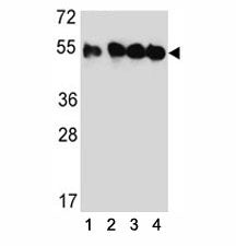TUBB2C Antibody (Tubulin beta 2C)