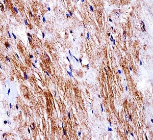 Ddr2 antibody immunohistochemistry analysis in formalin fixed and paraffin embedded mouse heart tiss