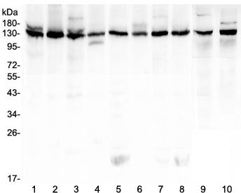Western blot testing of human 1) K562, 2) HeLa, 3) 293T, 4) A431, 5) Caco-2, 6) PC-3, 7) MCF7, 8) U-