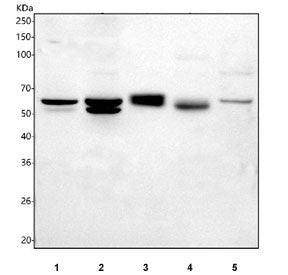 Western blot testing of 1) rat brain, 2) rat C6, 3) mouse eye, 4) mouse brain and 5) mouse Neuro-2a