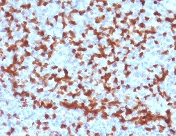 IHC testing of FFPE human tonsil with ZAP70 antibody (clone ZPT70-2). HIER: boil tissue sections in