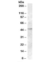 TMPRSS4 Antibody