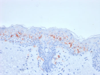 IHC testing of FFPE human skin with recombinant CD1a antibody (clone rC1A/711). Required HIER: boil